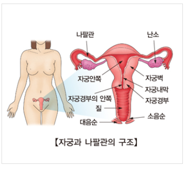 생리불순